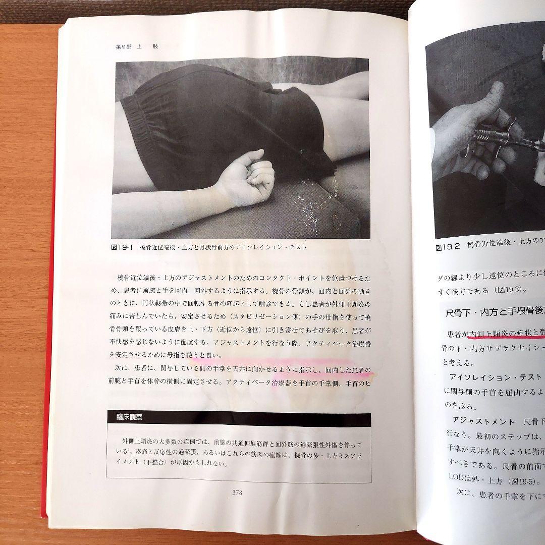アクティベーターメソッド　カイロプラクティック・テクニック