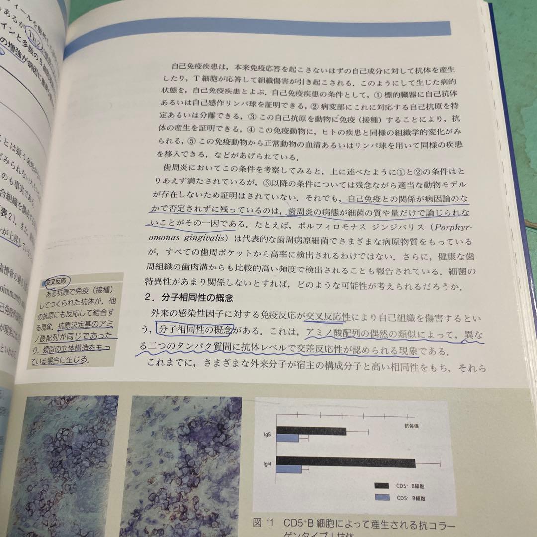 ❤️❤️❤️❤️歯周病診断のストラテジー