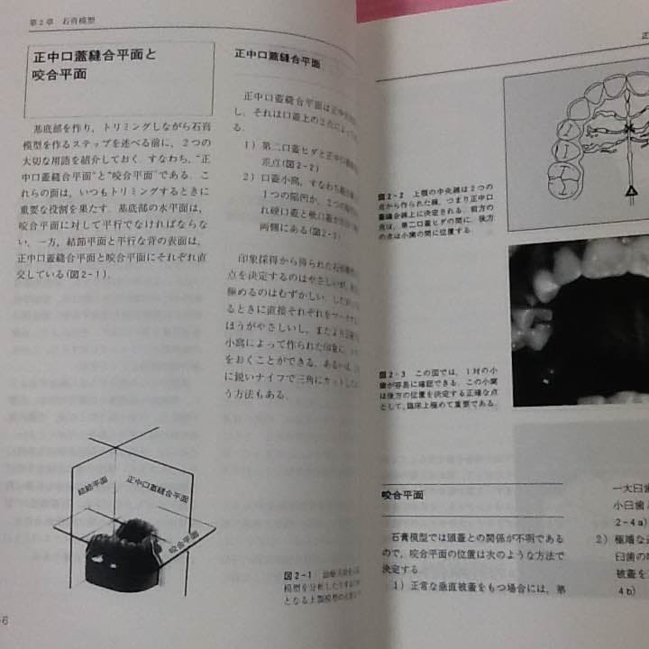 可撤式矯正装置入門
