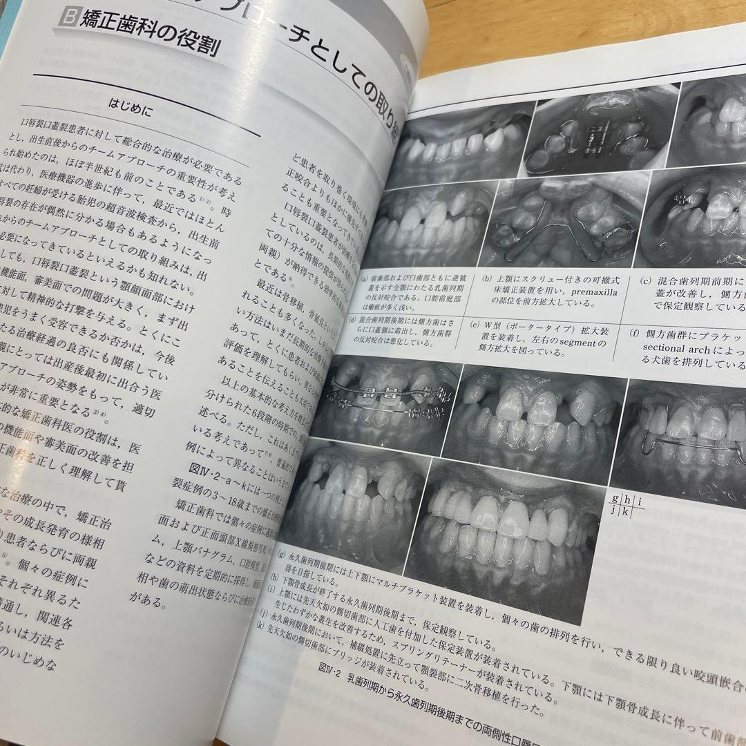 口唇裂口蓋裂の総合治療 成長に応じた諸問題の解決