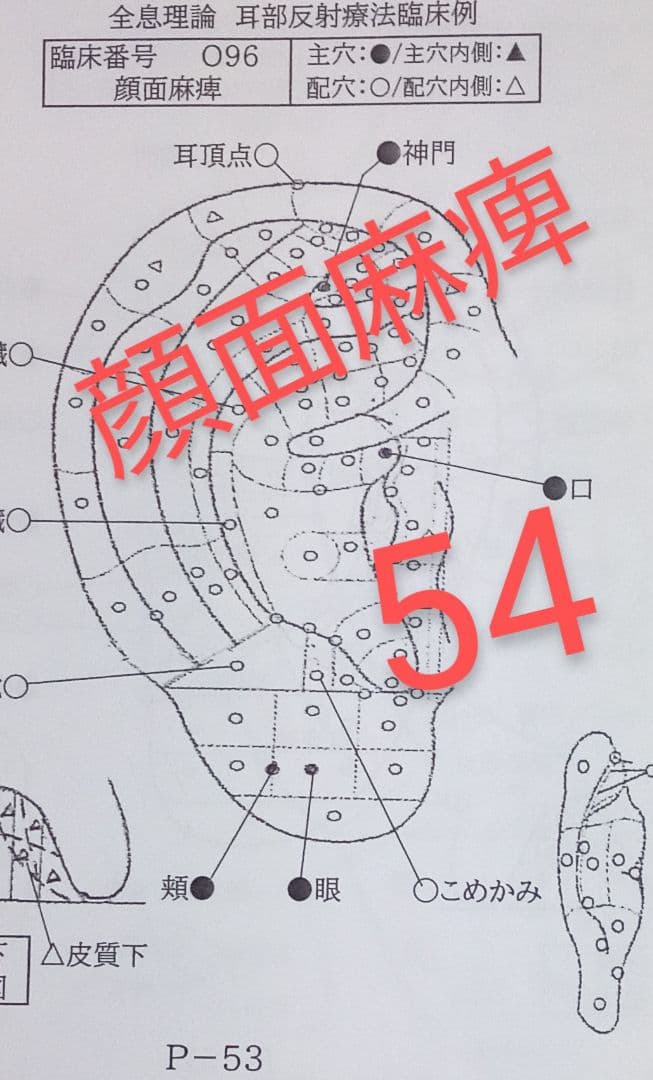 Bc耳臨床54例集+臓器躯体ラミネート加工+解説プリント13set
