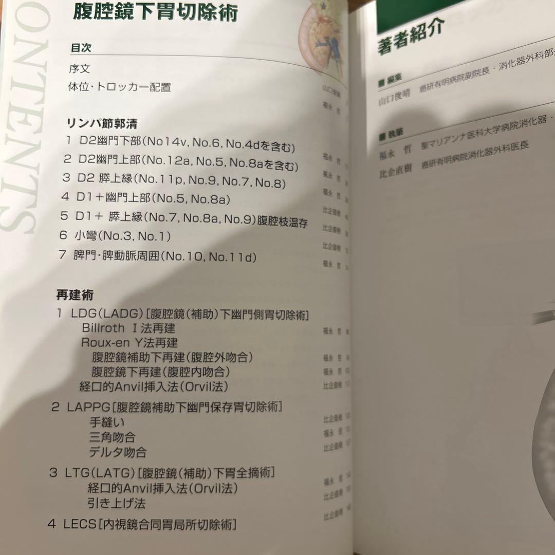 腹腔鏡下胃切除術 癌研スタイル
