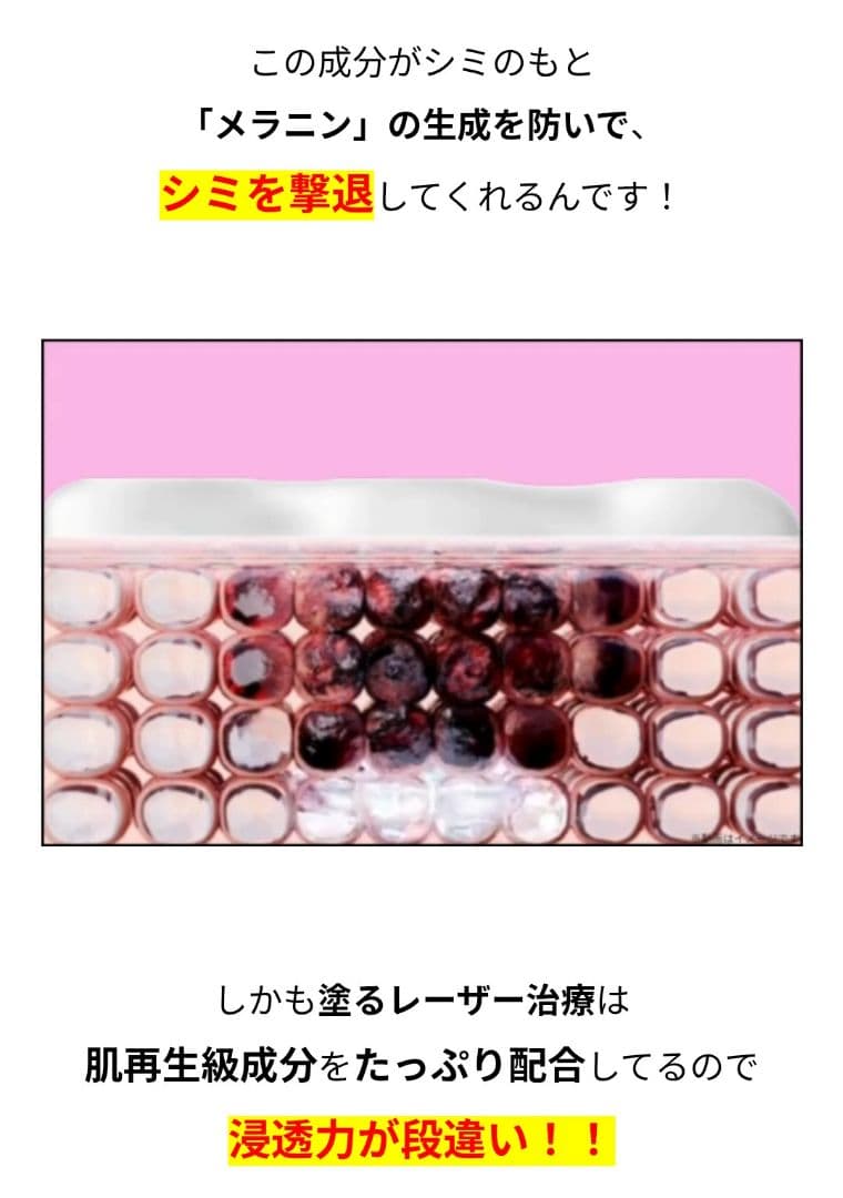 Lumie're ヴァレシア クリーム 薬用クリームＭRH　11/1受取分
