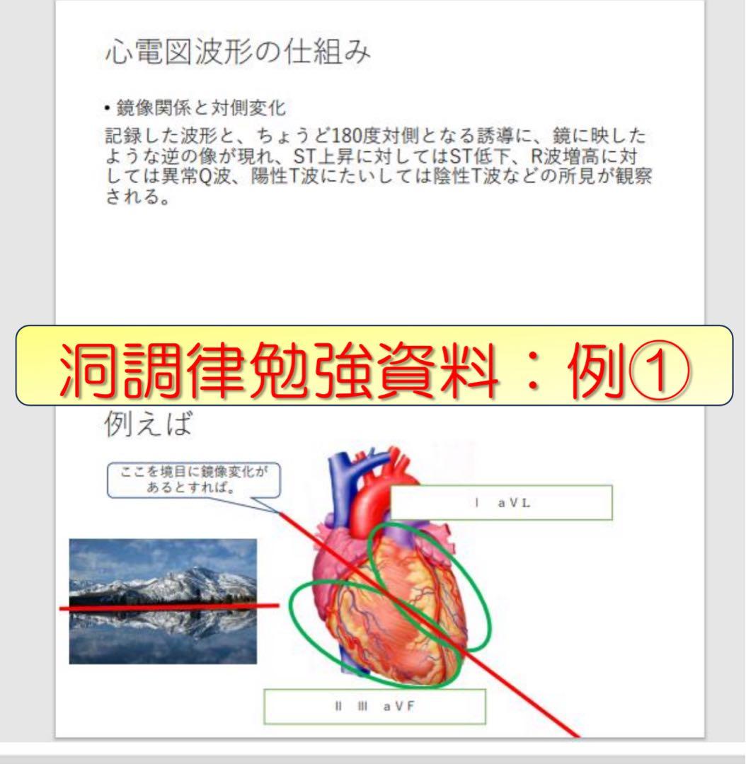 心電図検定対策7点セット
