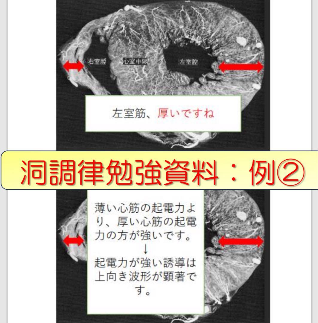 心電図検定対策7点セット