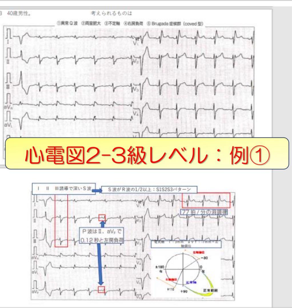 心電図検定対策7点セット