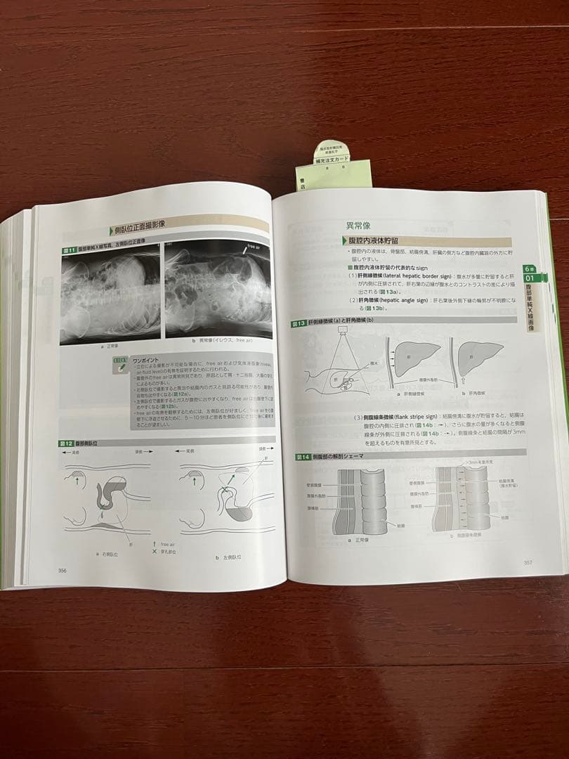 第三版　若葉マークの画像解剖学