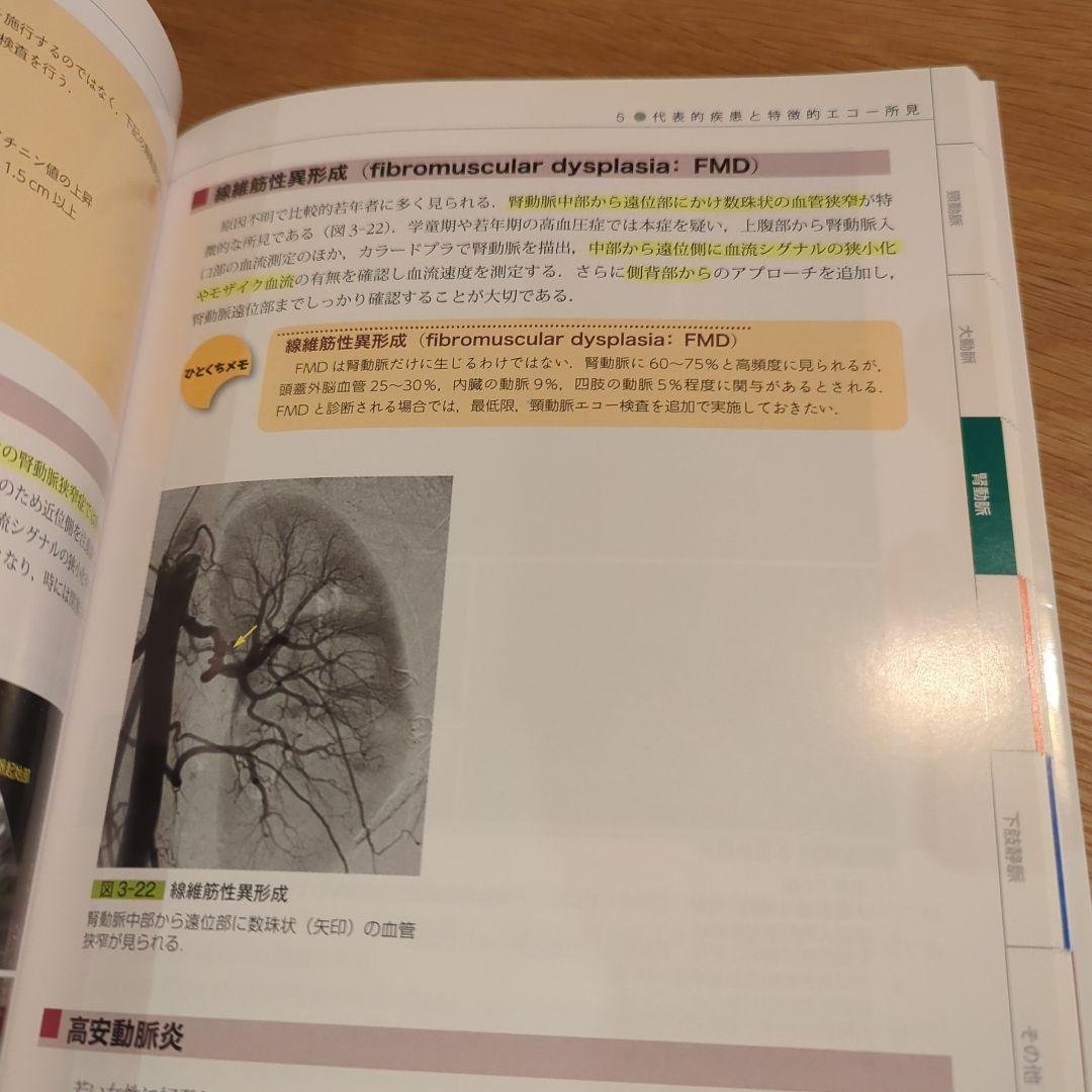 めざせ!血管エコー職人