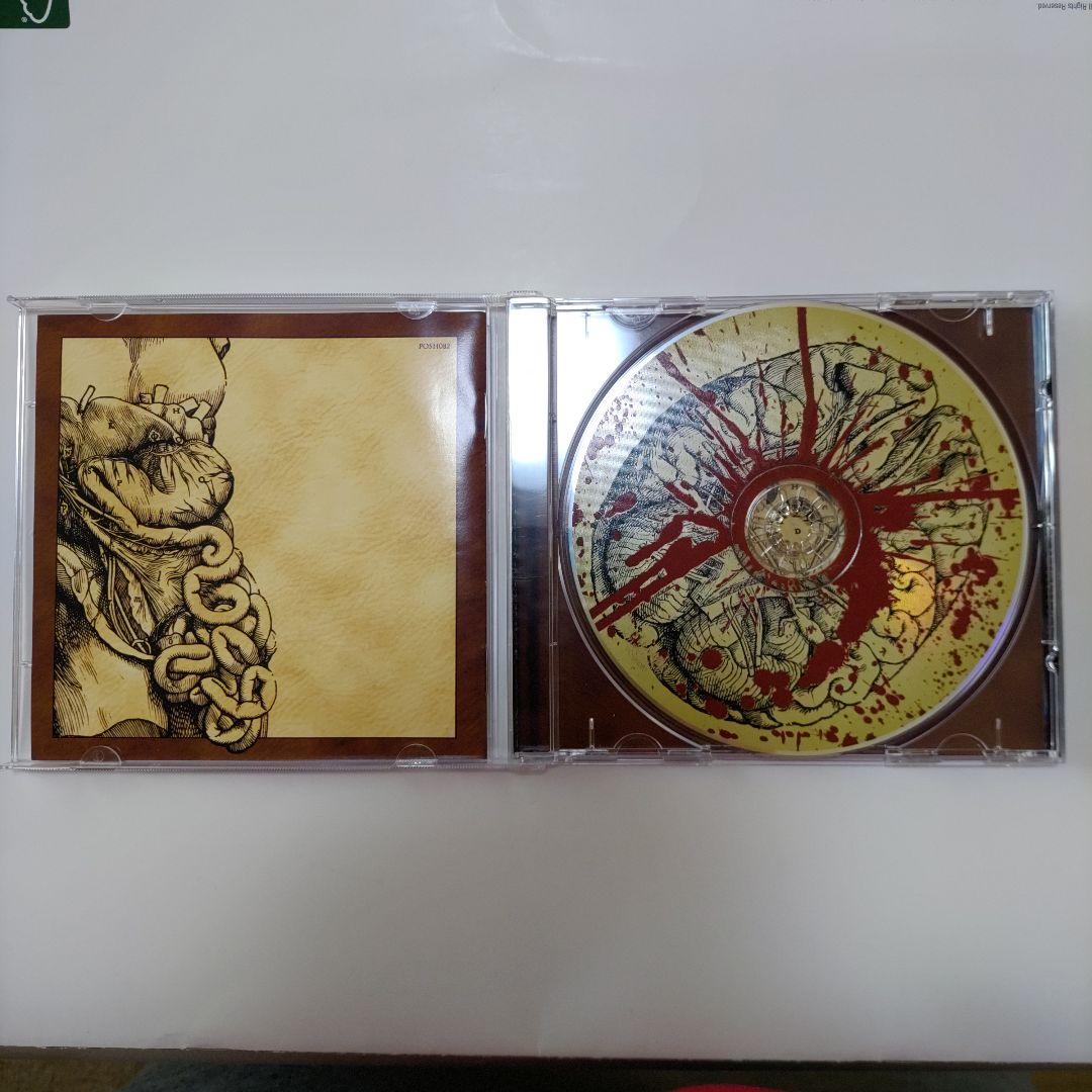 洋楽 General Surgery - Left Hand Pathology