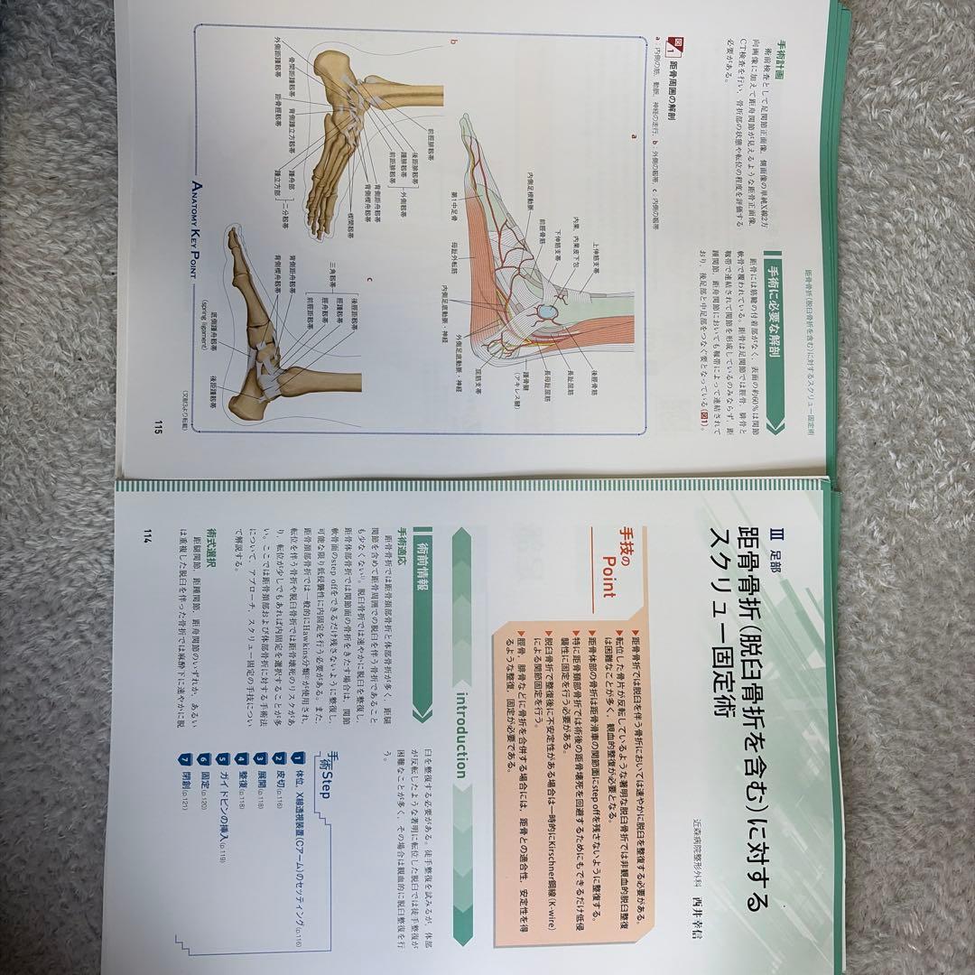 【裁断済】OS NEXUS 下肢の骨折手術② 膝～足部