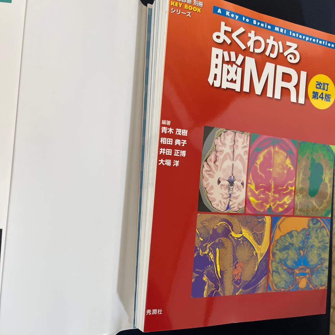 『裁断済』よくわかる脳MRI