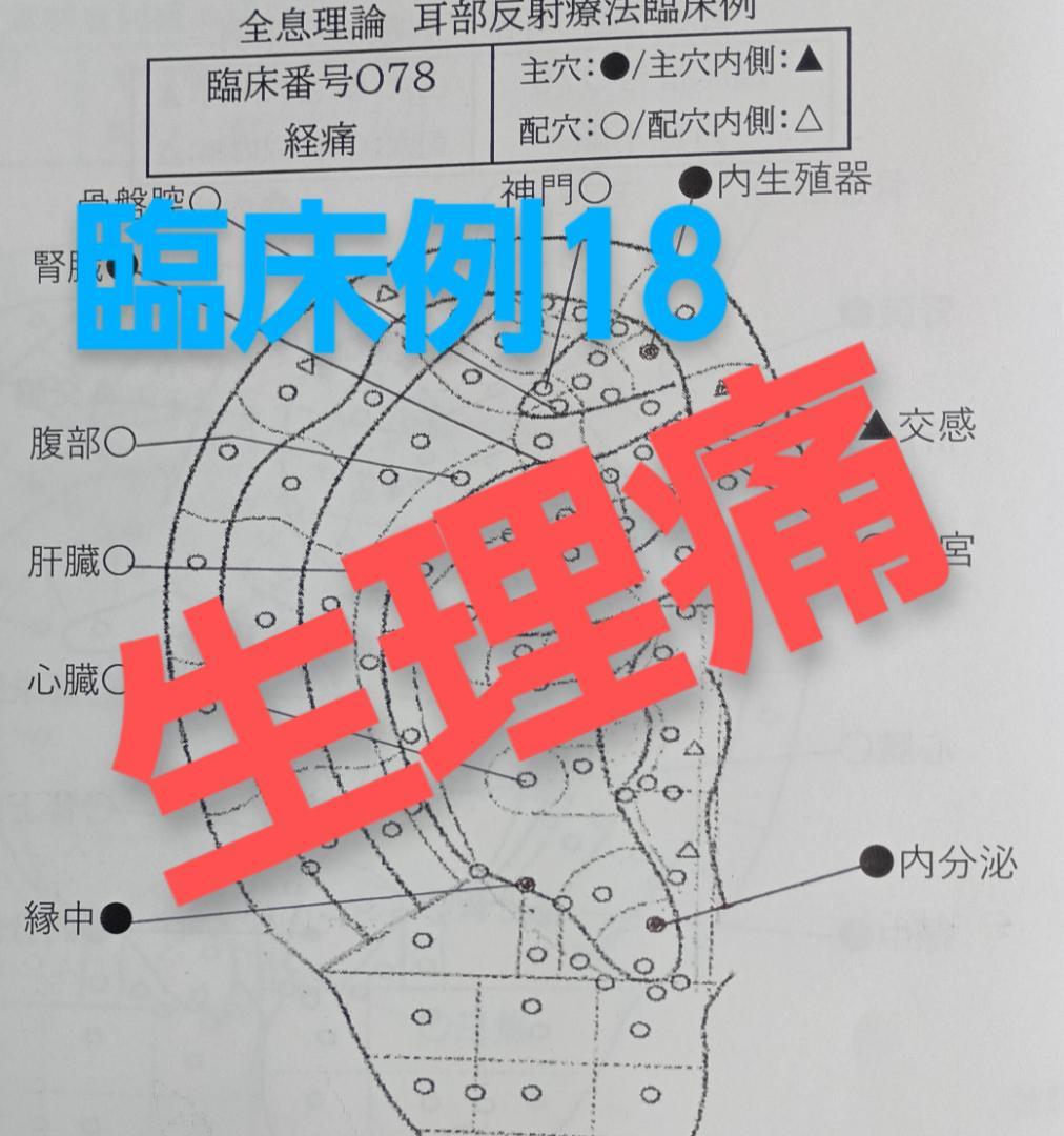 Bc:耳つぼ学ぶ：耳臨床54例集+臓器/躯体ラミネート+解説冊子/プリントset