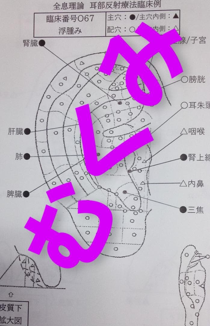 Bc:耳つぼ学ぶ：耳臨床54例集+臓器/躯体ラミネート+解説冊子/プリントset