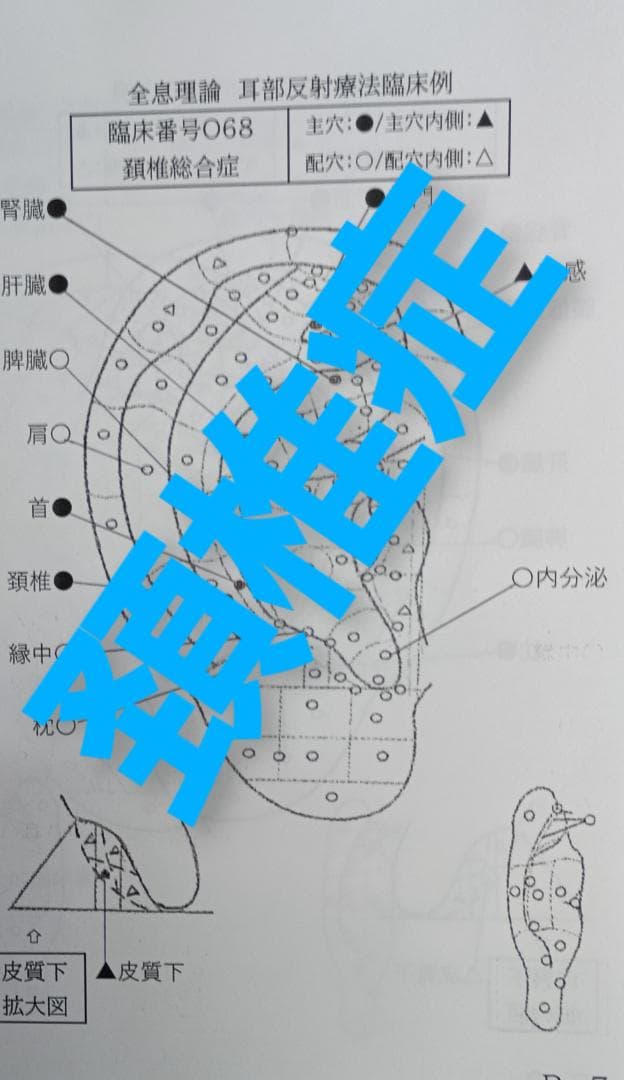 Bc:耳つぼ学ぶ：耳臨床54例集+臓器/躯体ラミネート+解説冊子/プリントset