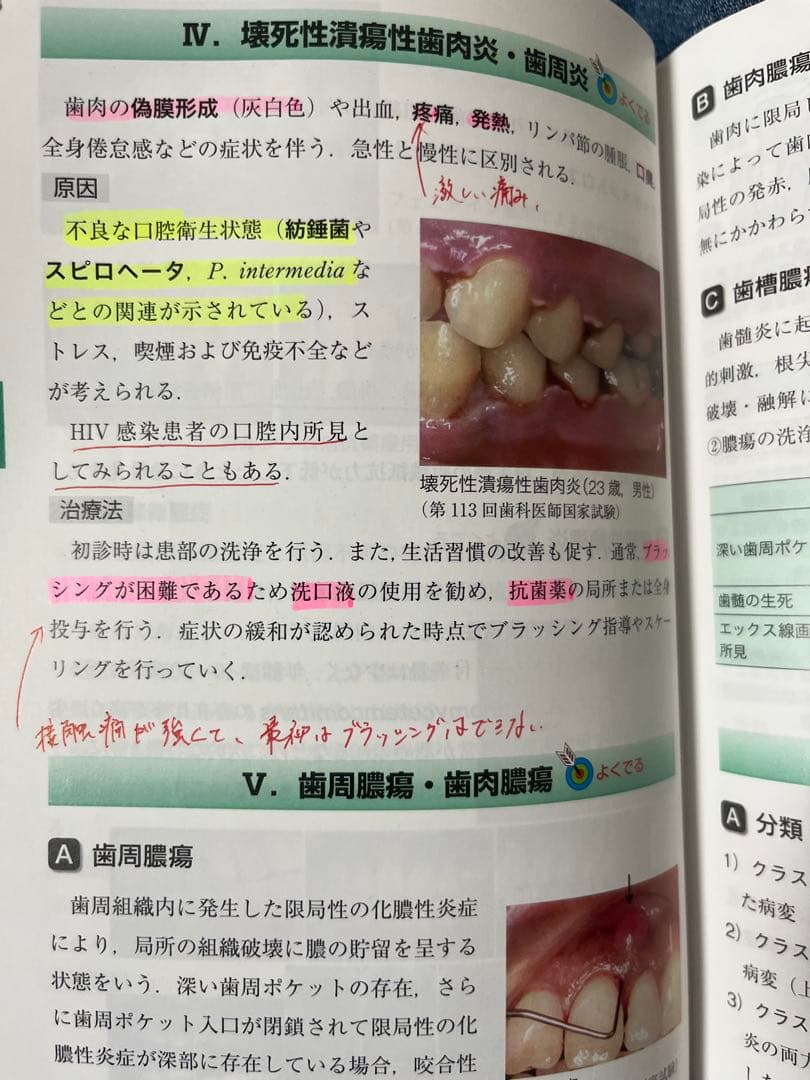 歯科国試パーフェクトマスター22冊セット