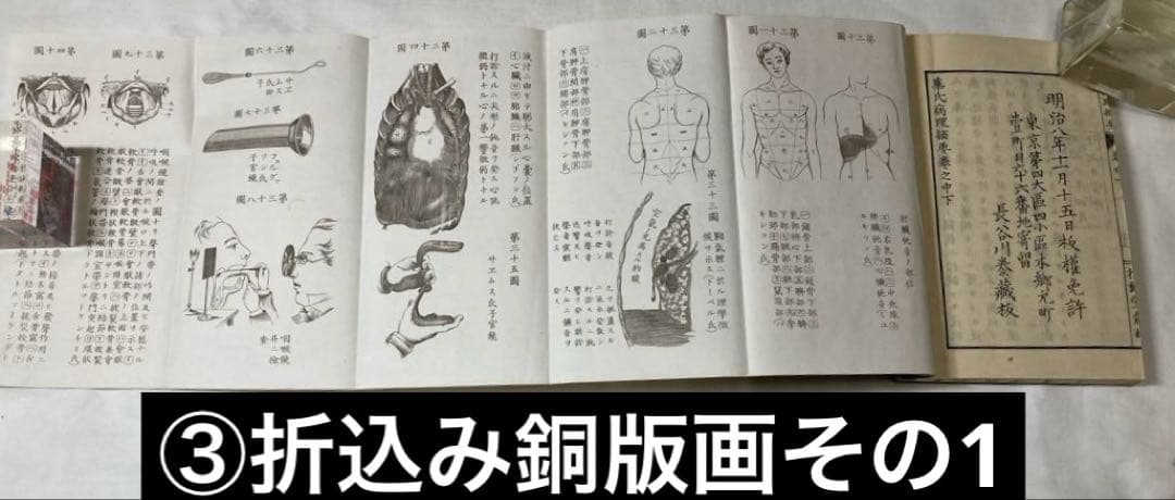 150年前・折込銅版図入・医学書【華氏病理摘要】5冊揃い完本