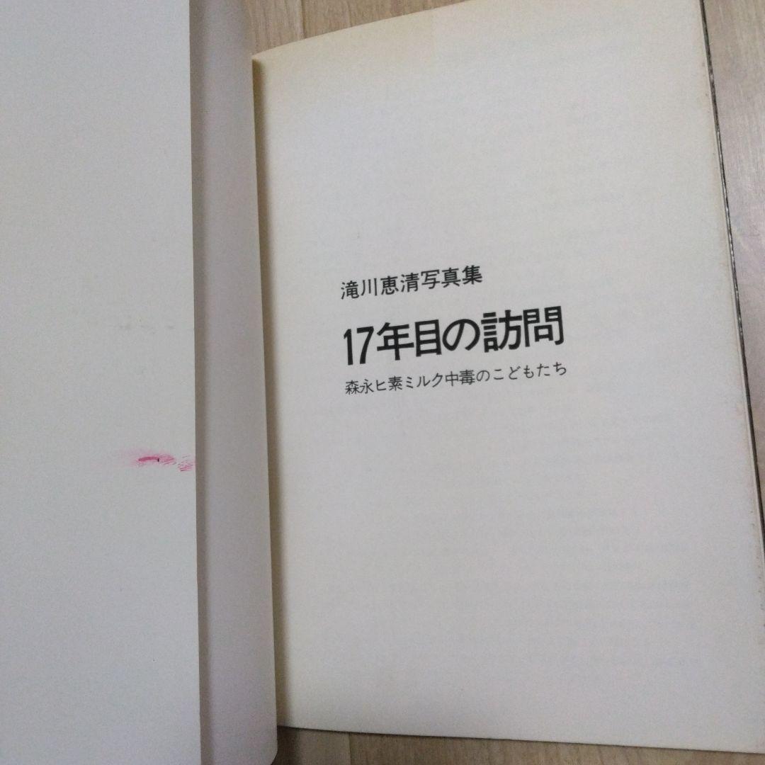 滝川恵清写真集　十七年目の訪問　森永ヒ素ミルク中毒のこどもたち　滝川恵清