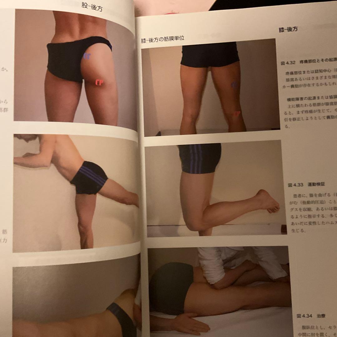 筋膜マニピュレーション : 筋骨格系疼痛治療 実践編