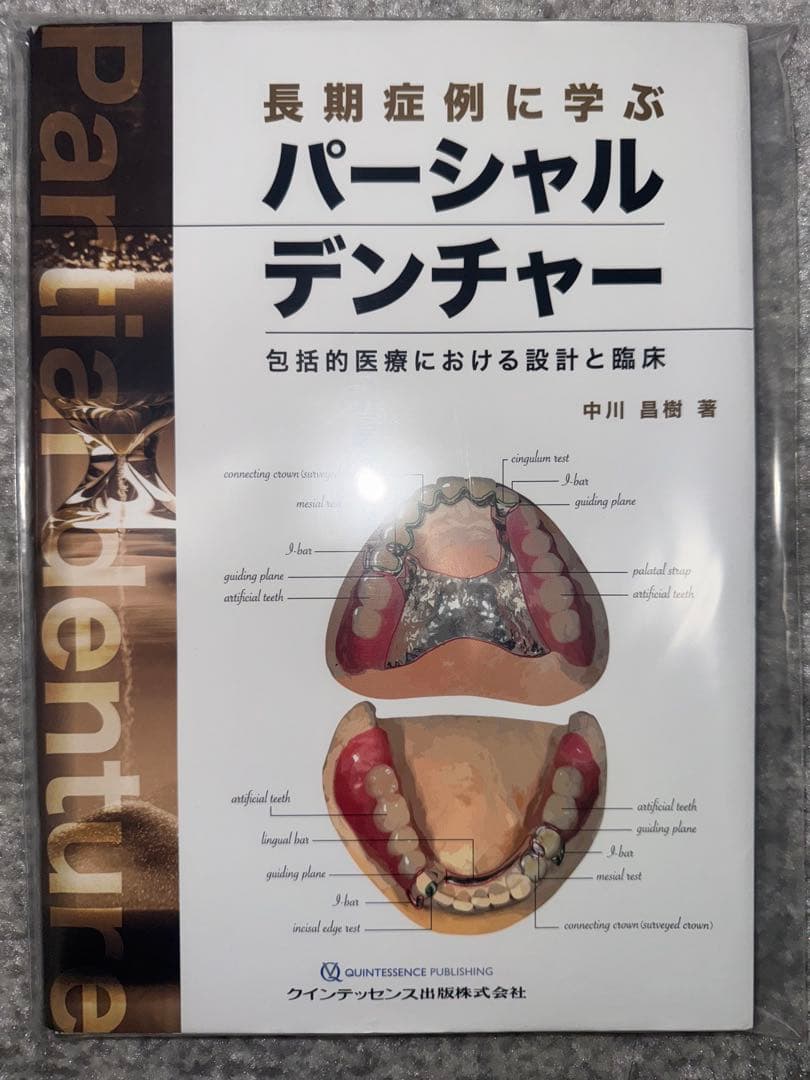 【裁断済み】長期症例に学ぶパーシャルデンチャー