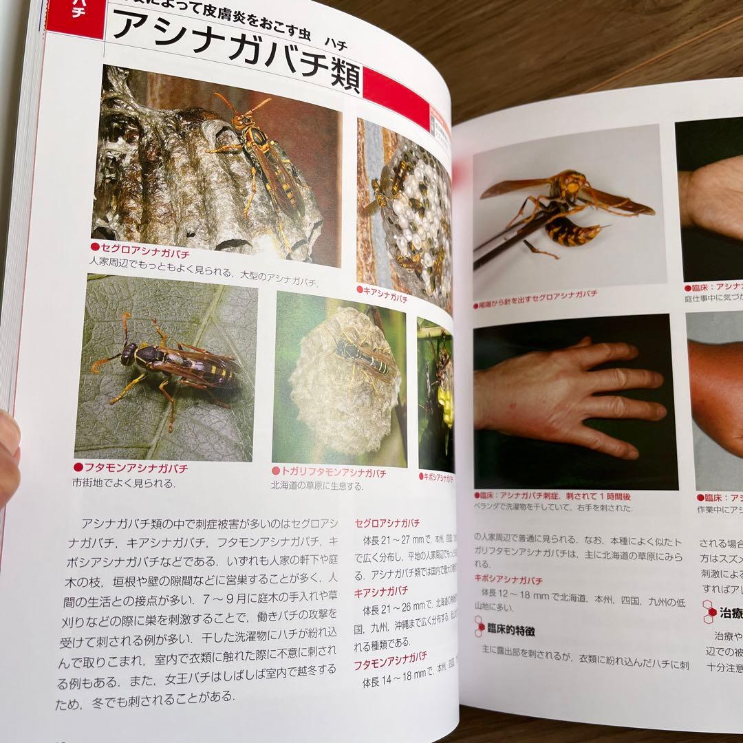 Dr.夏秋の臨床図鑑 虫と皮膚炎
