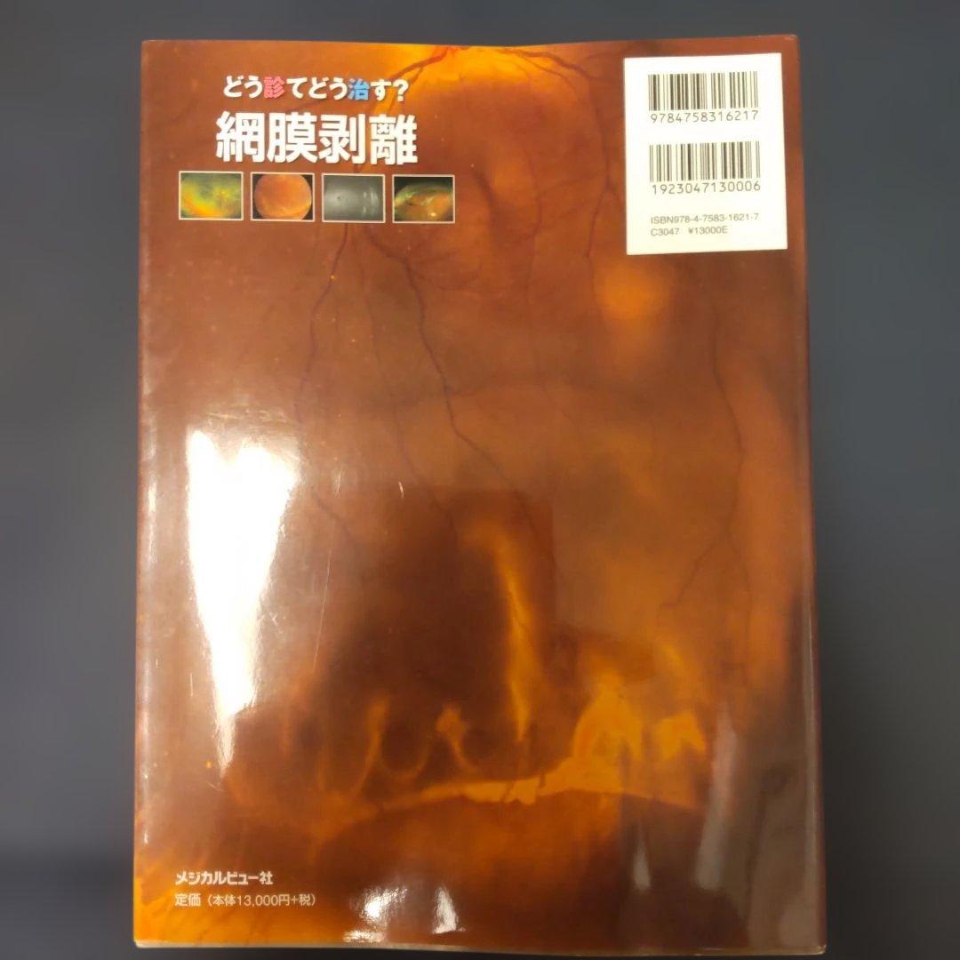 どう診てどう治す?網膜剥離