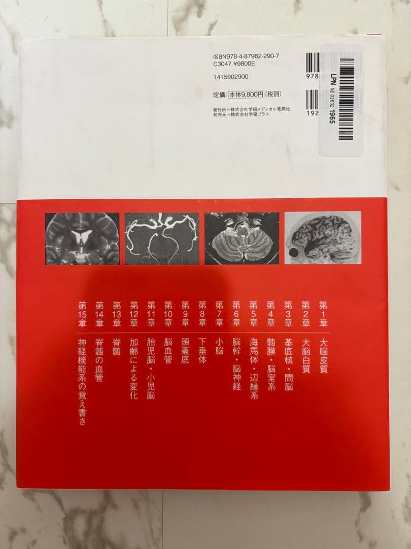 脳MRI