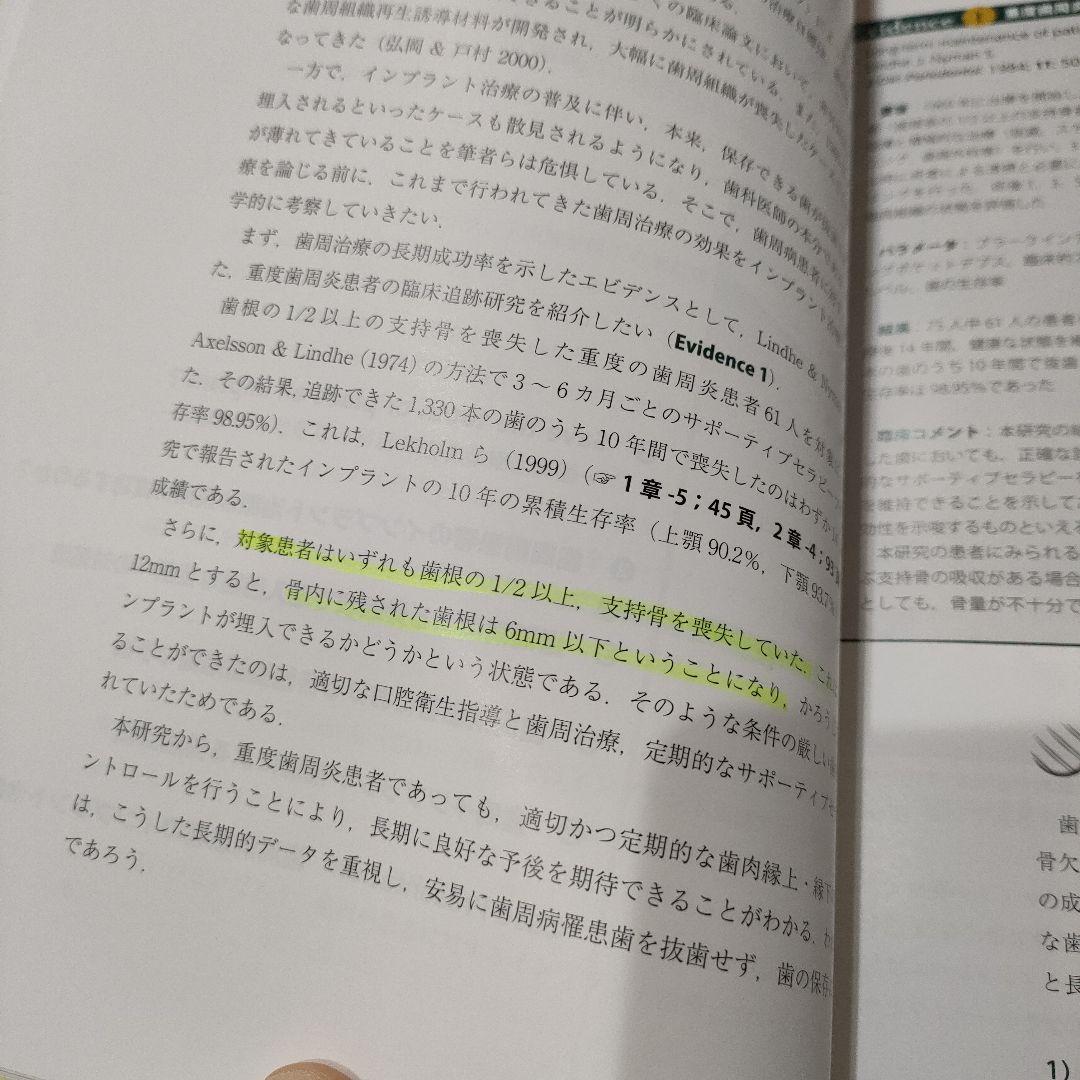 歯周病患者のインプラント治療