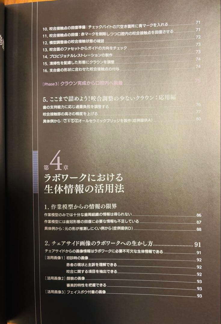 生体と調和する歯周組織にやさしい歯冠修復物