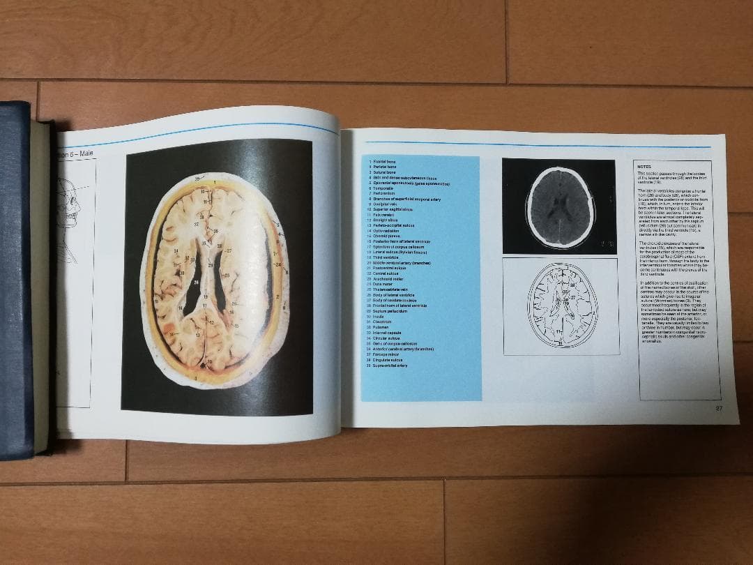 解剖学書籍 HUMAN CROSS-SECTIONAL ANATOMY 値下げ
