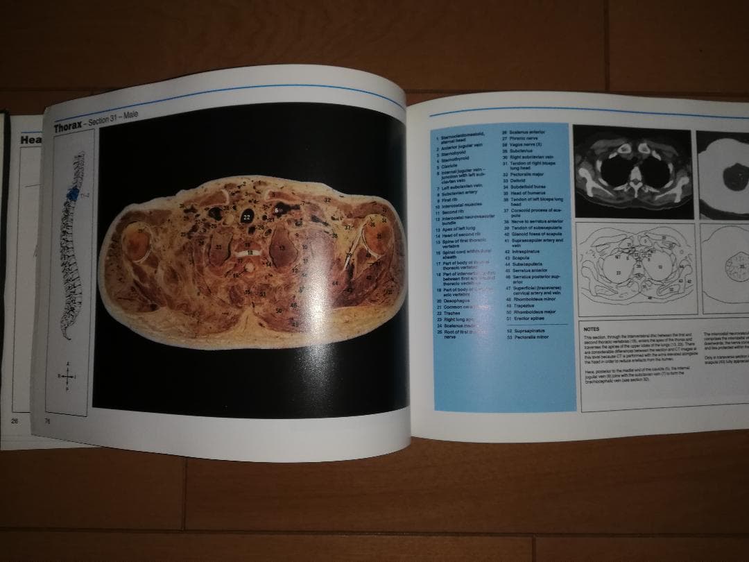 解剖学書籍 HUMAN CROSS-SECTIONAL ANATOMY 値下げ