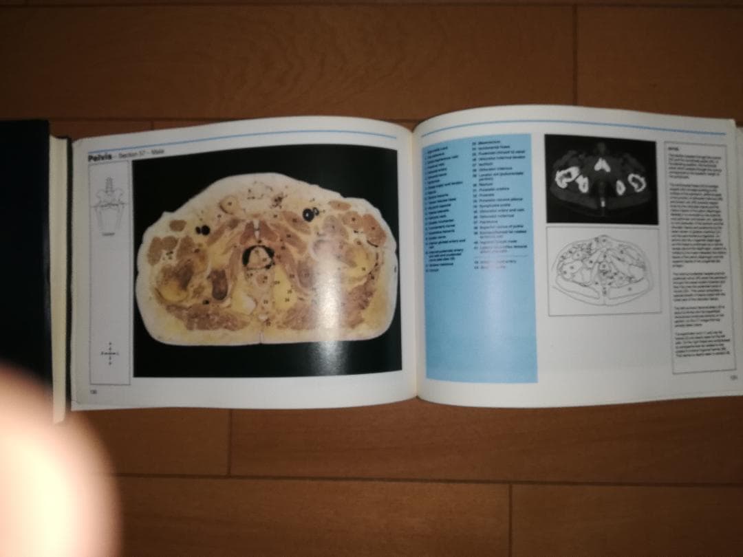 解剖学書籍 HUMAN CROSS-SECTIONAL ANATOMY 値下げ
