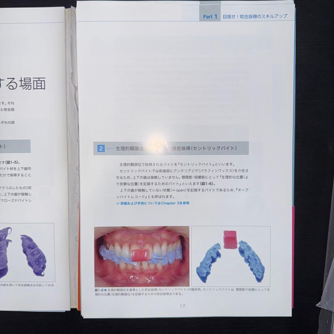 よくわかる咬合採得　裁断済み