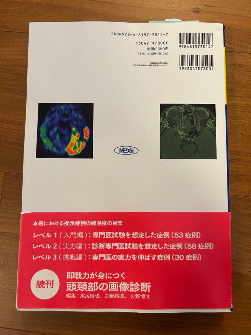 脳の画像診断