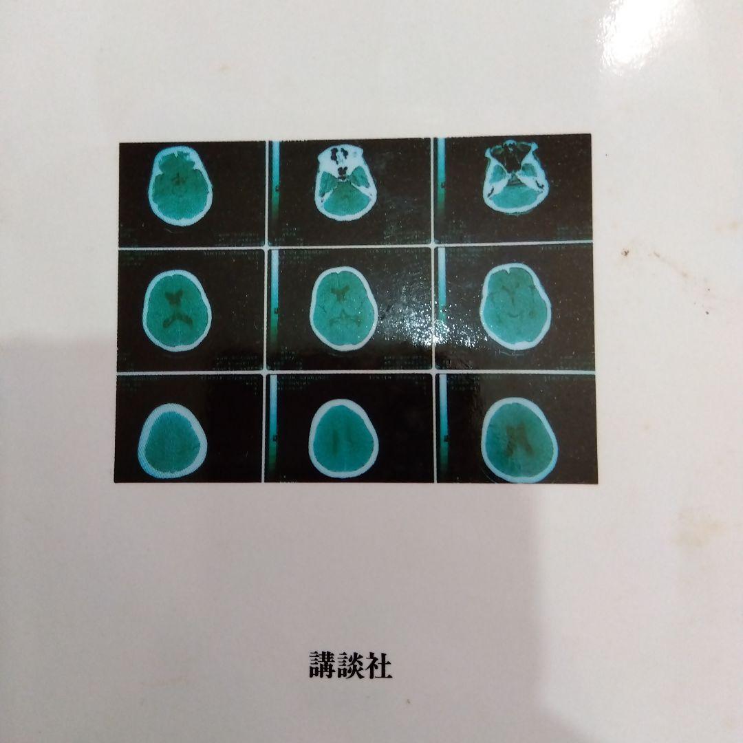 やられてたまるか脳卒中！ 防げる！治せる！予防と治療の最新知識 富永紳介 講談社