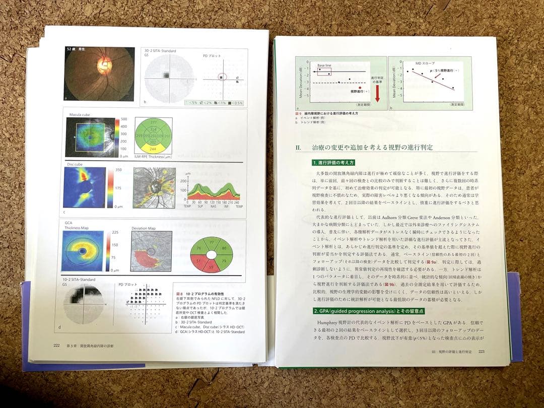 All About 開放隅角緑内障（裁断済み）