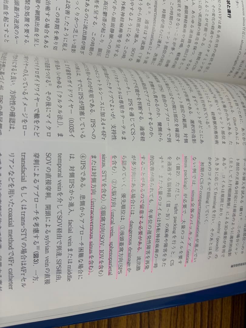 値下げ！硬膜動静脈瘻のすべて DVD付寺田友昭