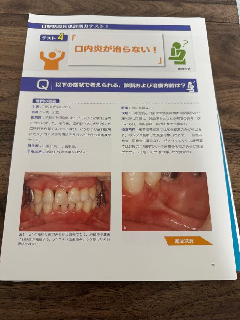 臨床で遭遇する口腔粘膜疾患に強くなる本　裁断済み