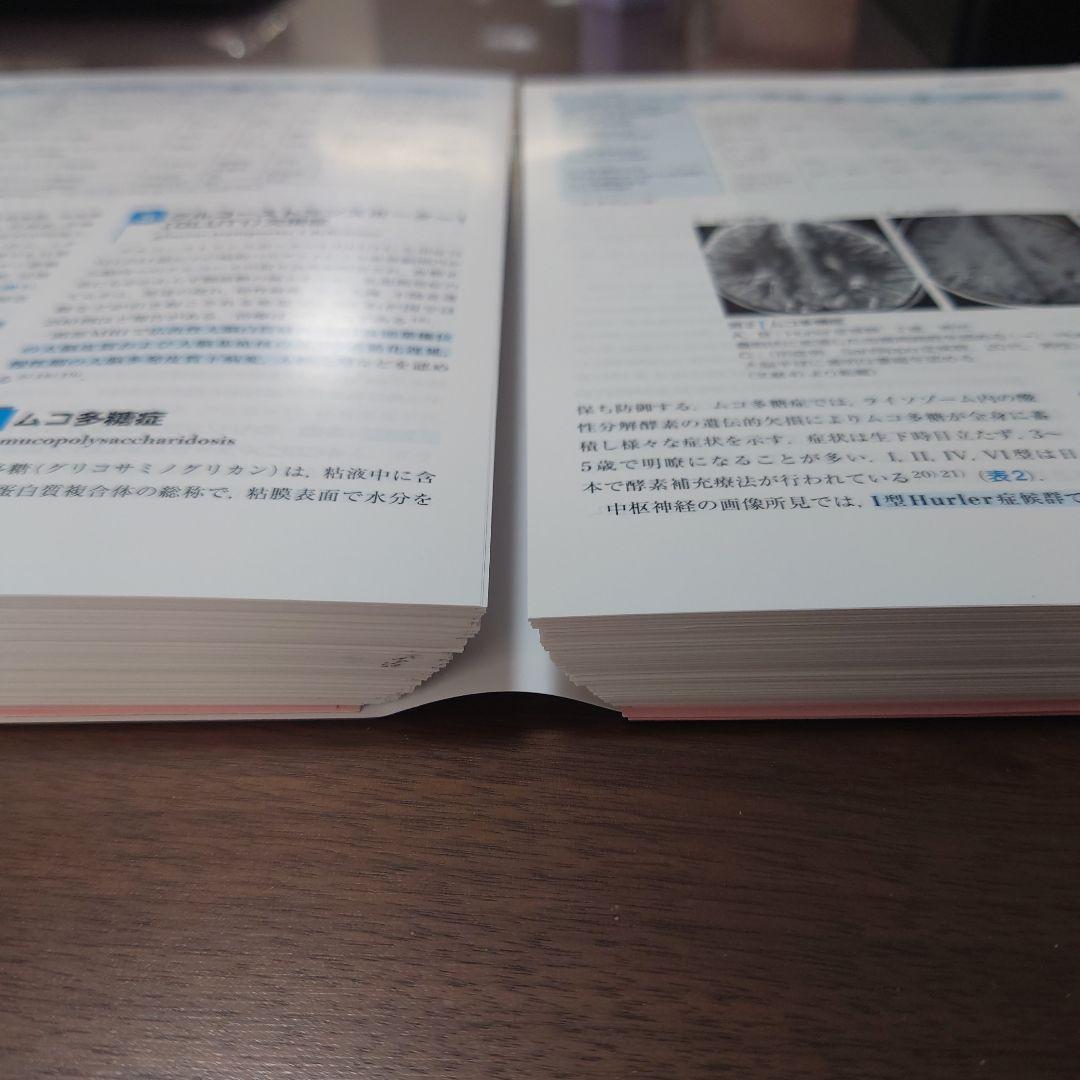 【裁断済】小児神経の画像診断 第2版