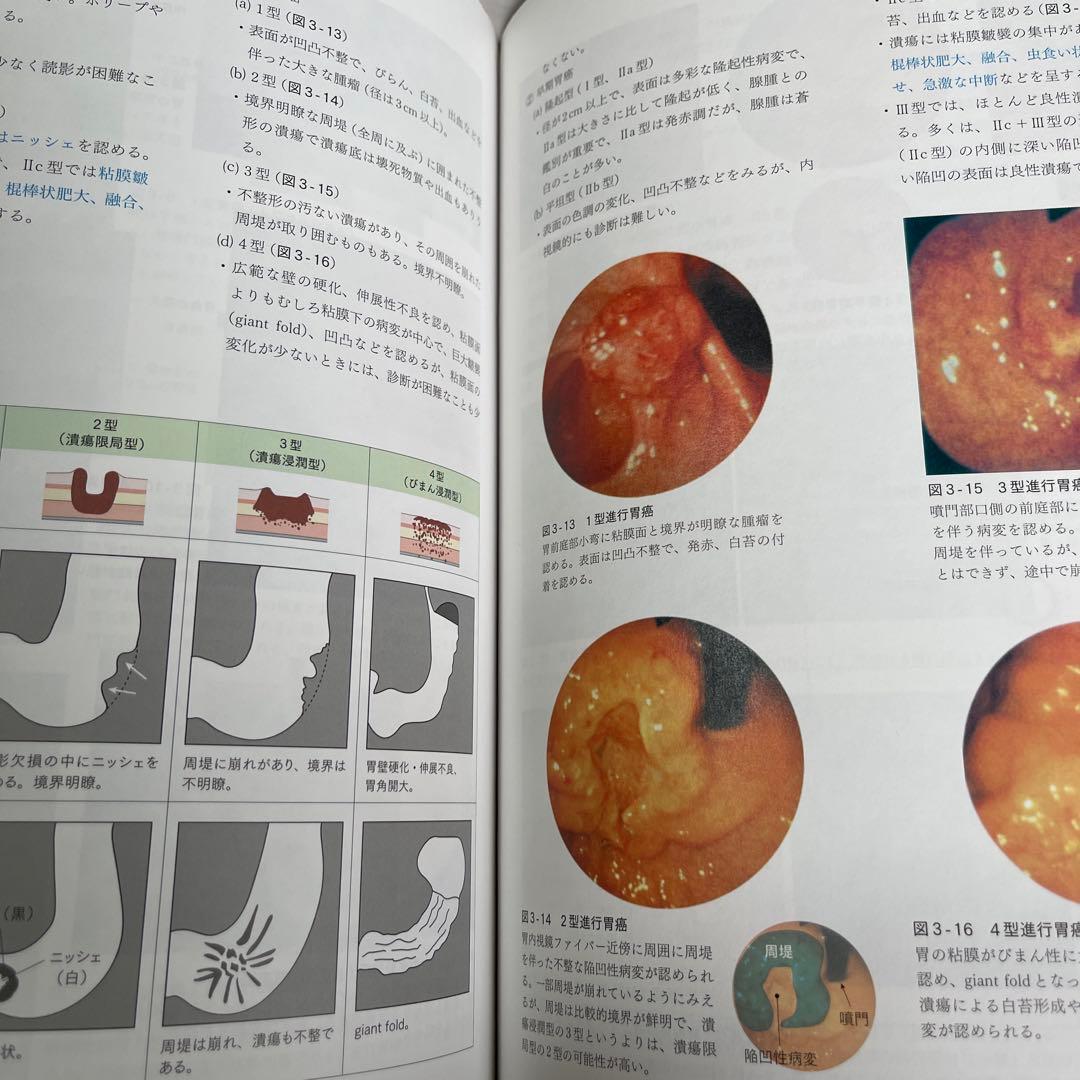 i medicine 1〜8巻セット売り 医師国家試験対策におすすめ