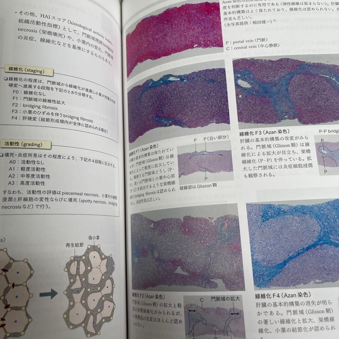 i medicine 1〜8巻セット売り 医師国家試験対策におすすめ