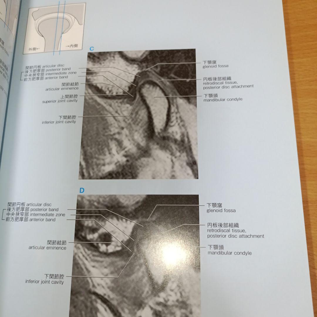 【名作運動器リハ】関節のMRI 第2版　画像理学療法作業療法リハビリ整形外科