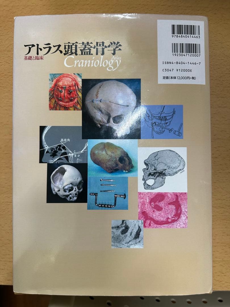アトラス頭蓋骨学　医療書　整形外科　医学　骨学　クラニオロジー　医学書　解剖学