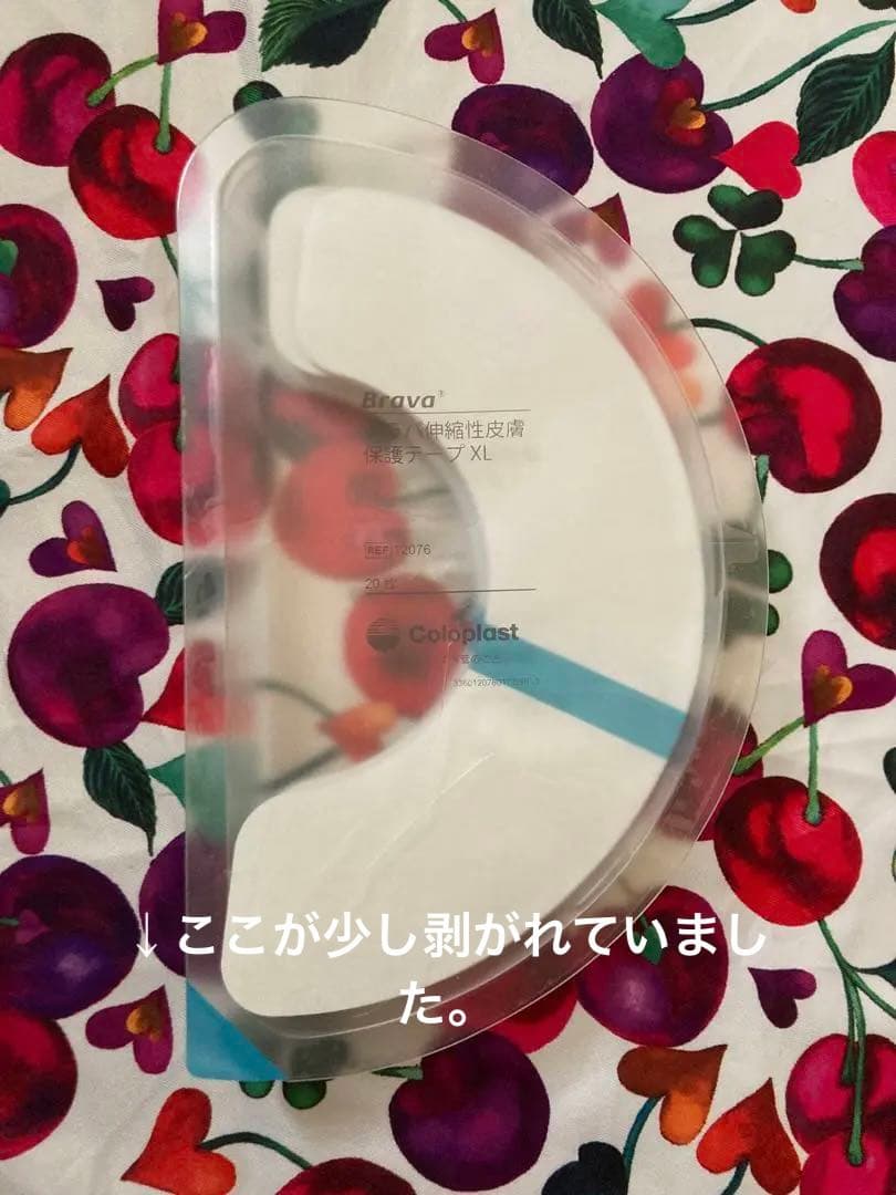 ストーマセット
