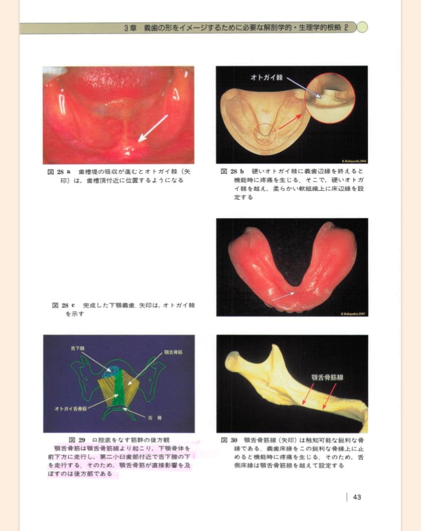 【裁断済】【即日発送】総義歯臨床の押さえどころ