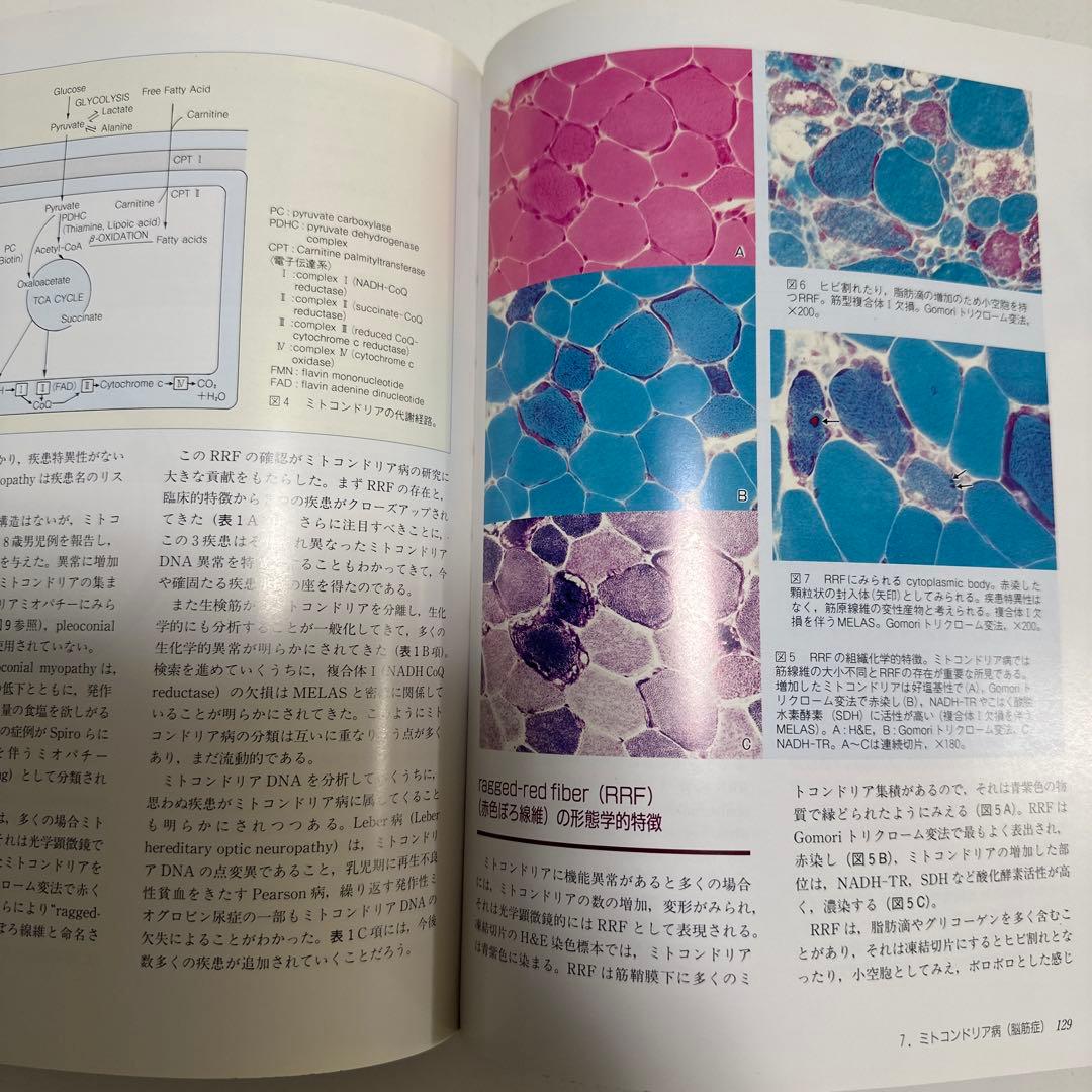 臨床のための筋病理