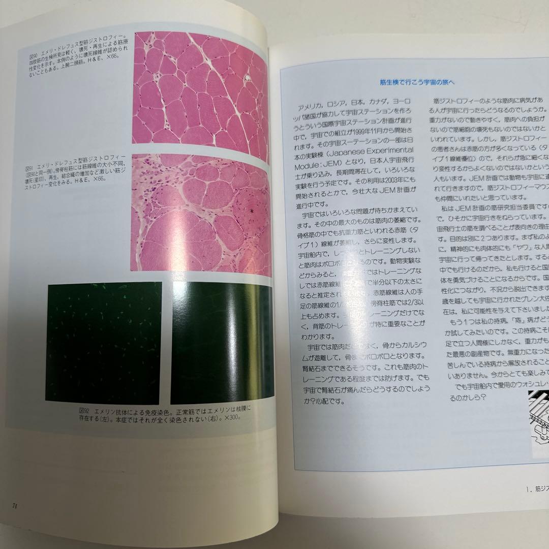 臨床のための筋病理
