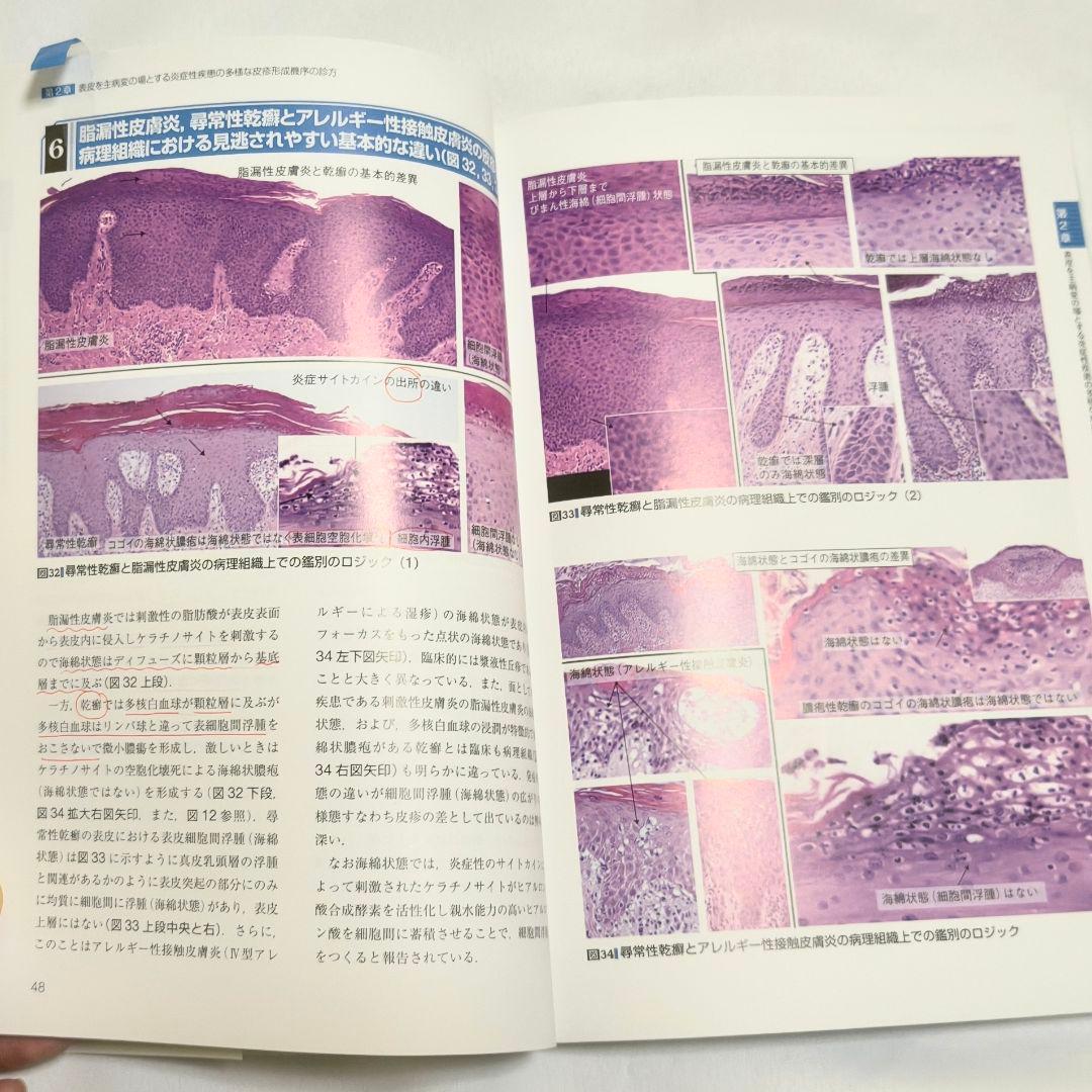 皮膚の因数分解・ロジック診断