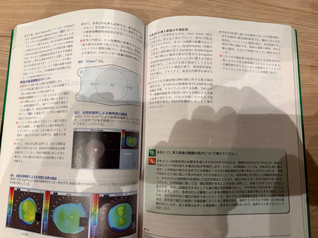 眼科診療マイスター II 診断と治療