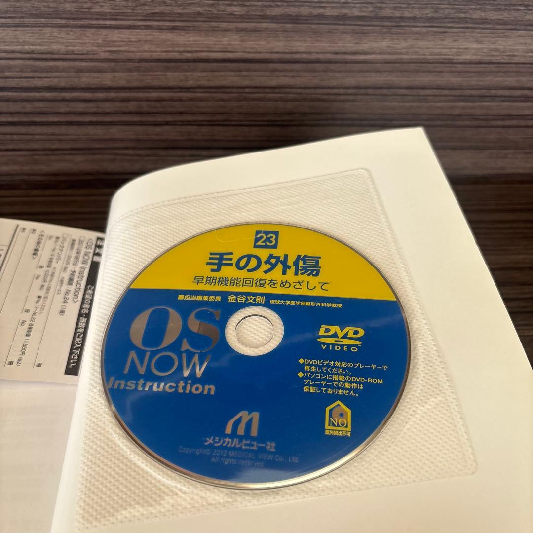 手の外傷 : 早期機能回復をめざして