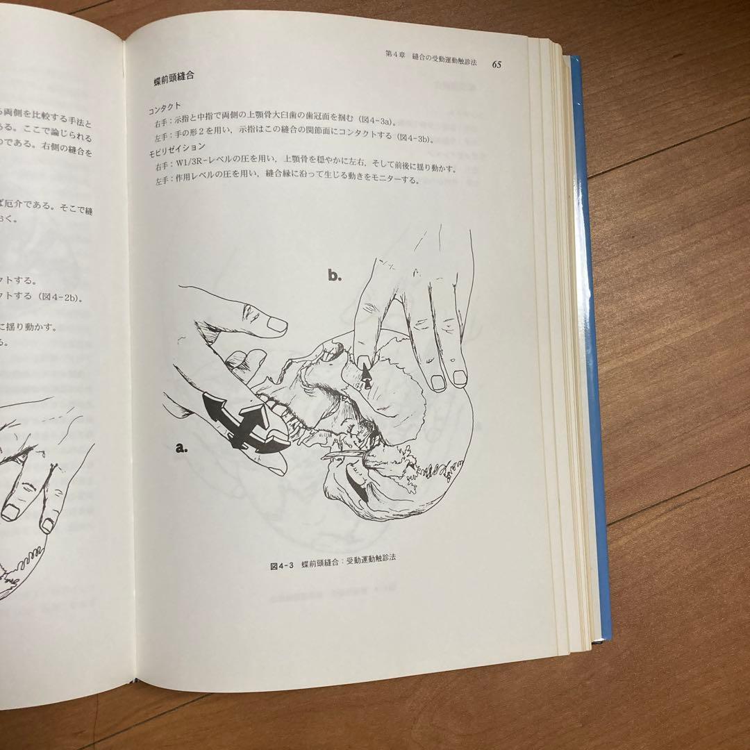 頭蓋縫合